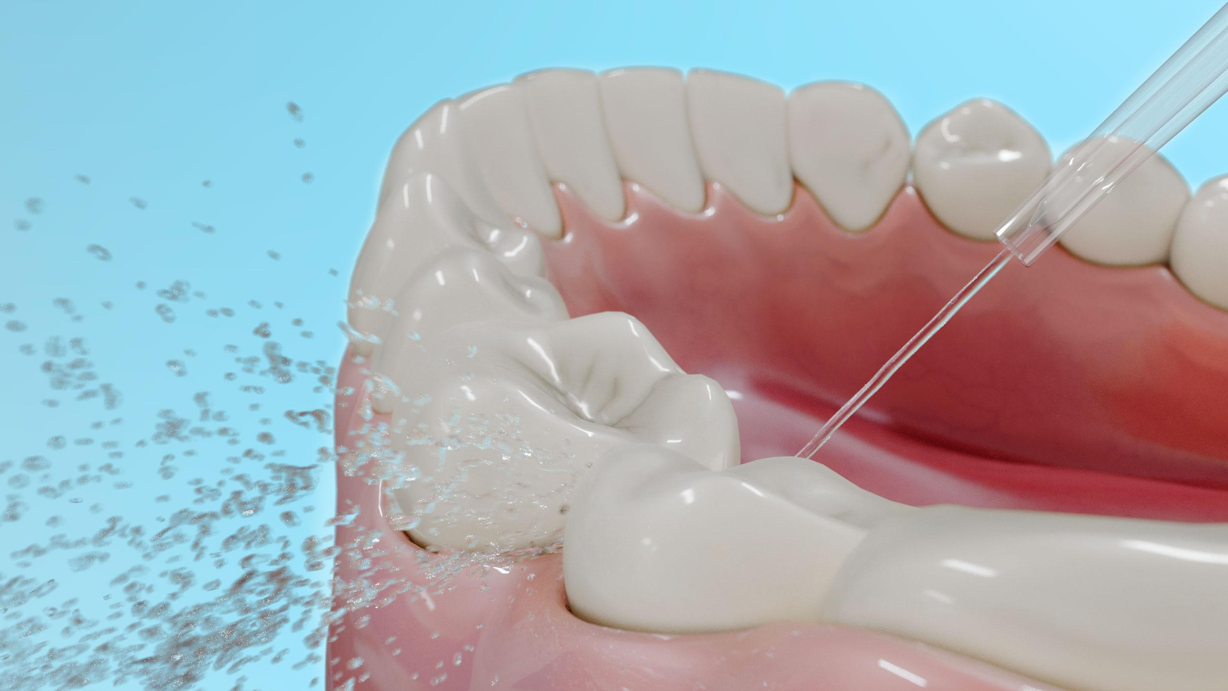 Cecotec TOOTH CARE 1200