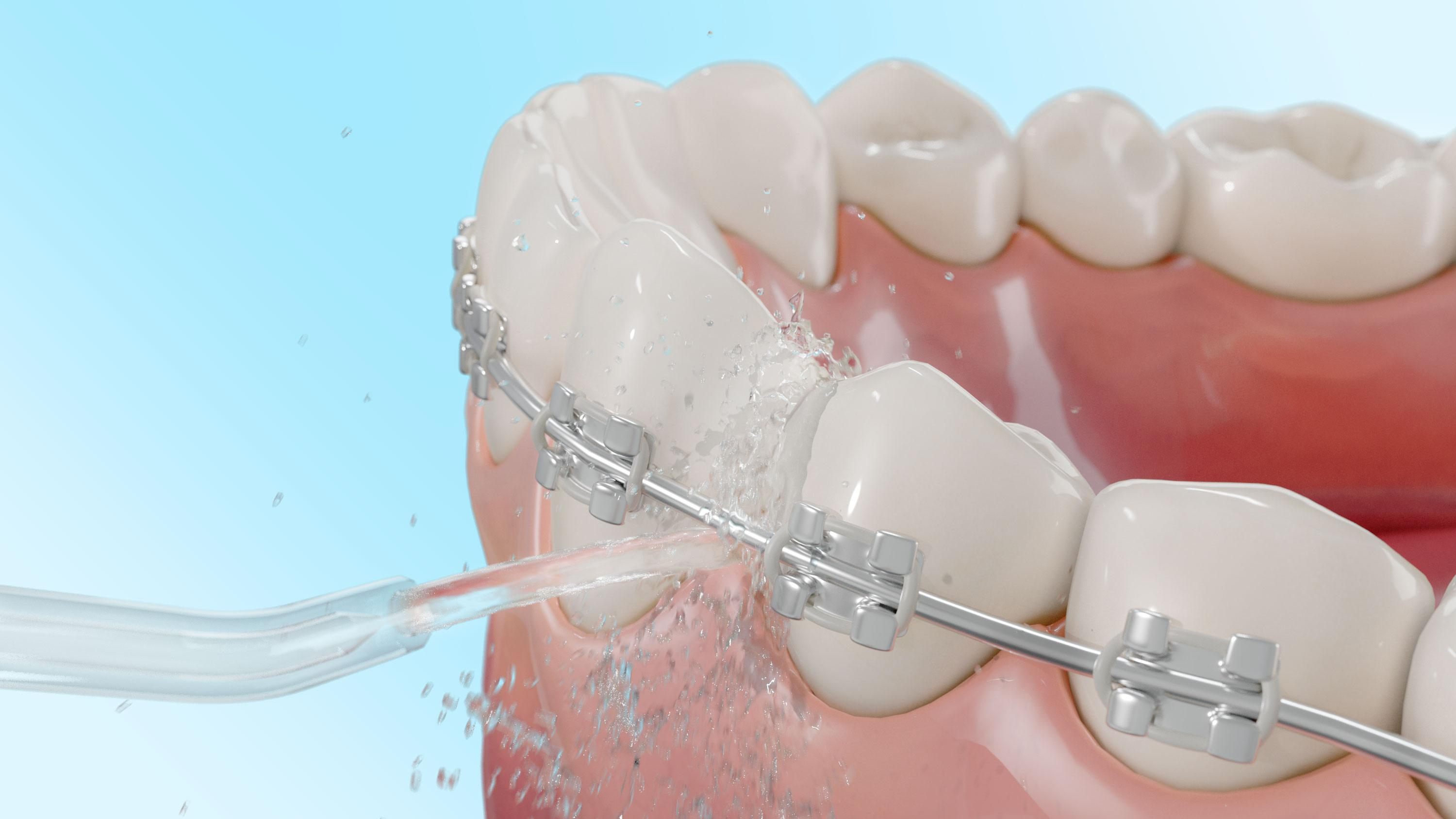 Cecotec TOOTH CARE 1200