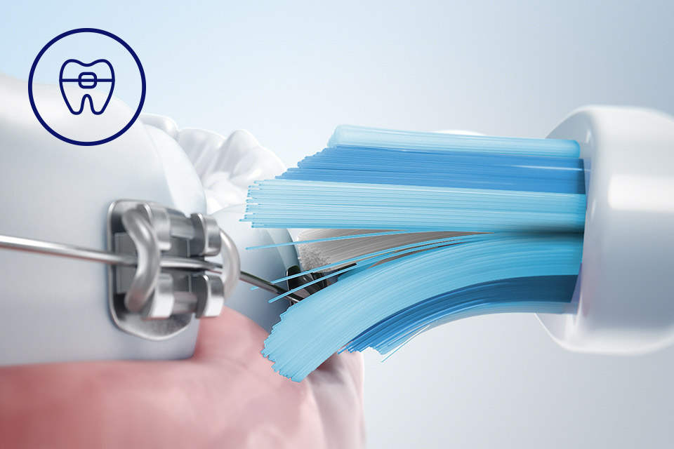 Philips Bezpieczeństwo dla aparatów, implantów i koron