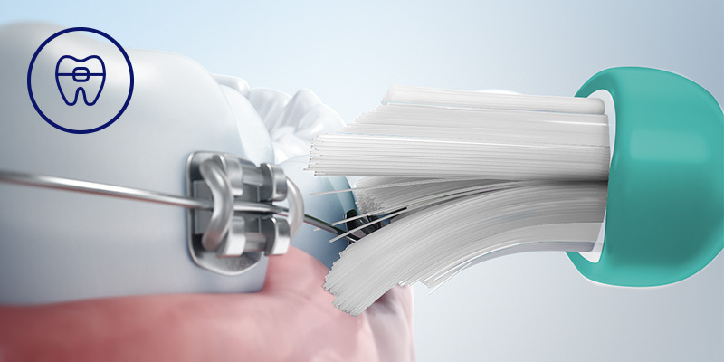 Philips Bezpieczeństwo dla aparat&oacute;w, implant&oacute;w i koron