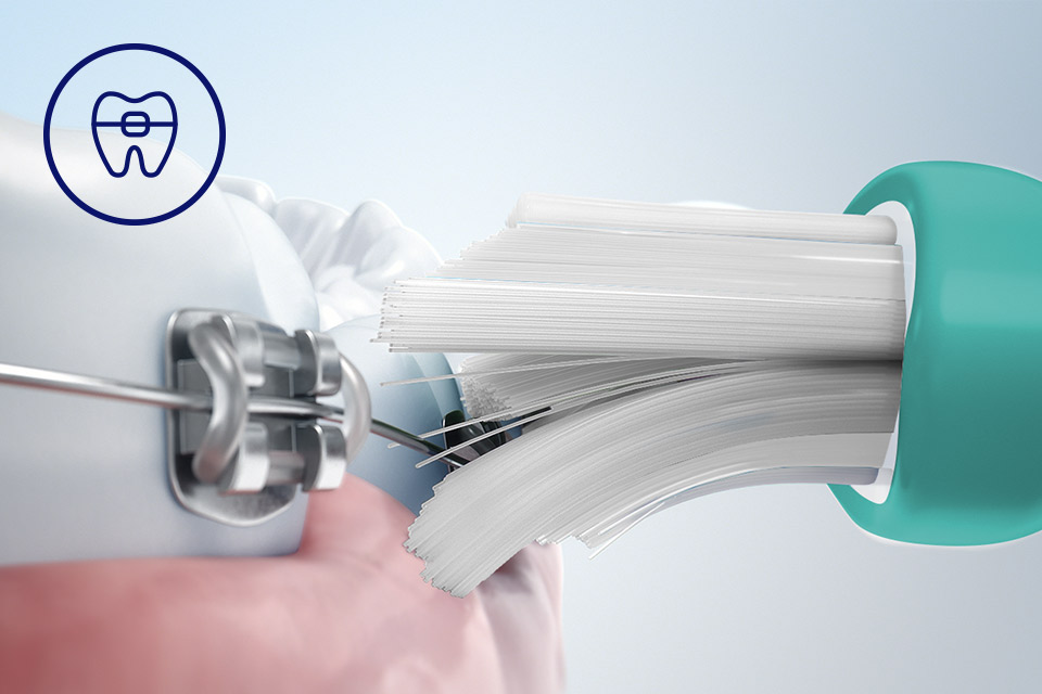 Philips Bezpieczeństwo dla aparat&oacute;w, implant&oacute;w i koron