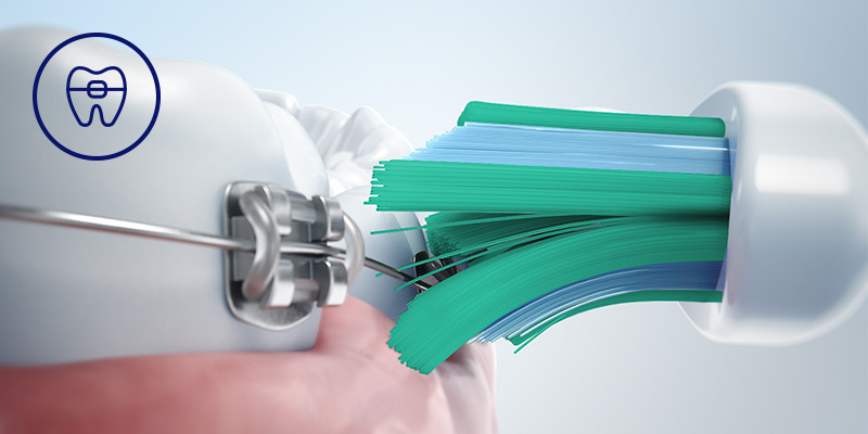Philips Bezpieczeństwo dla aparatów, implantów i koron