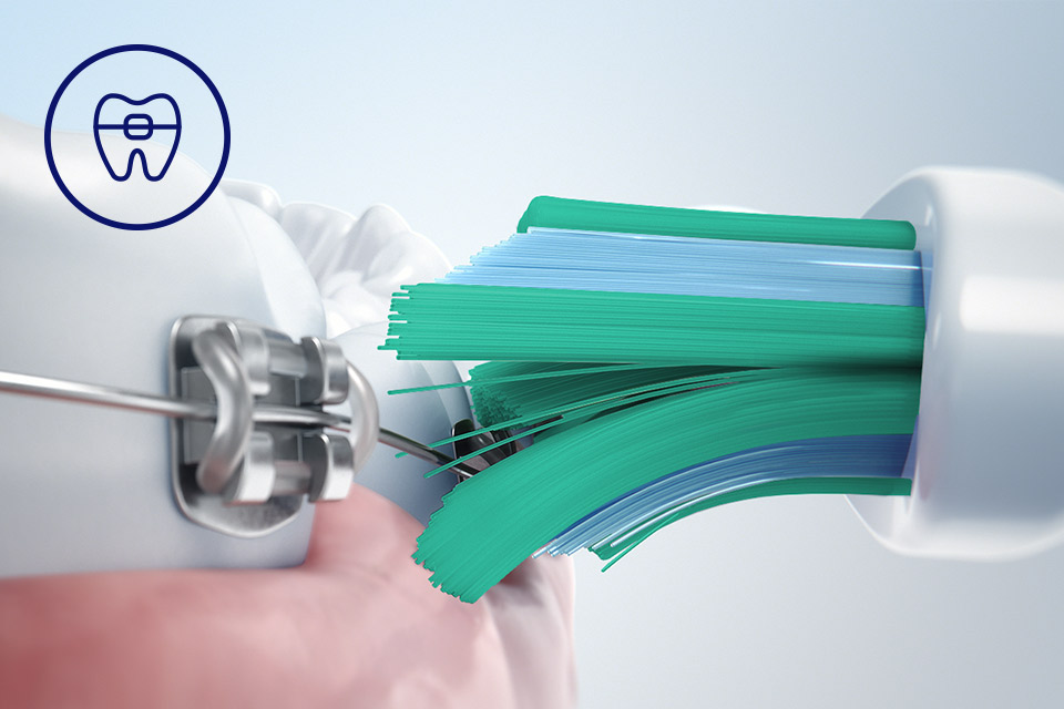Philips Bezpieczeństwo dla aparatów, implantów i koron