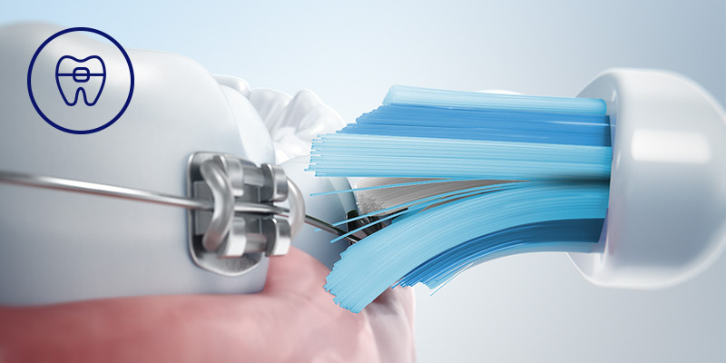 Philips Bezpieczeństwo dla aparat&oacute;w, implant&oacute;w i koron