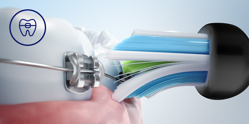 Philips Bezpieczeństwo dla aparatów, implantów i koron