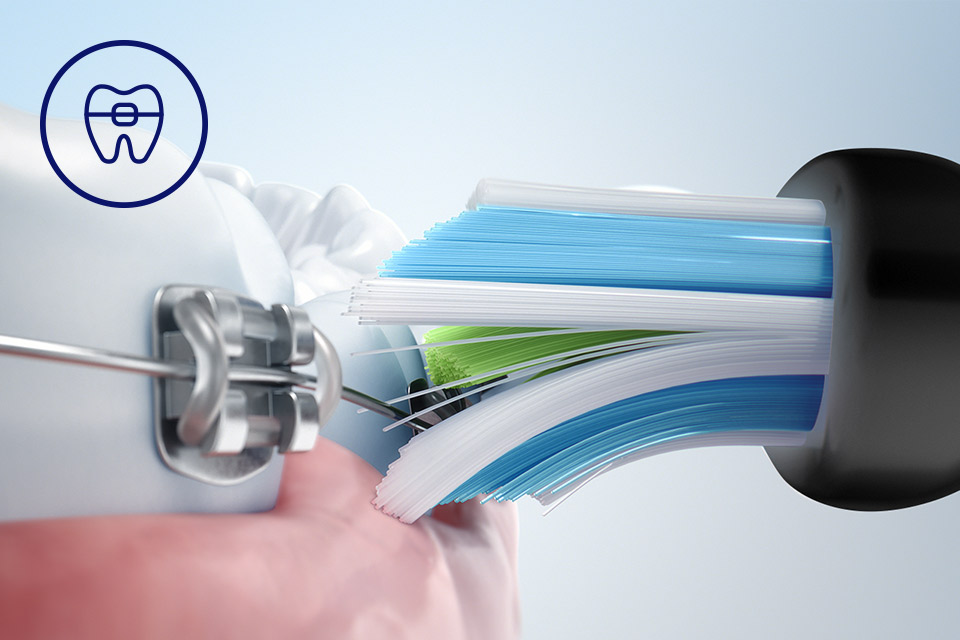Philips Bezpieczeństwo dla aparatów, implantów i koron