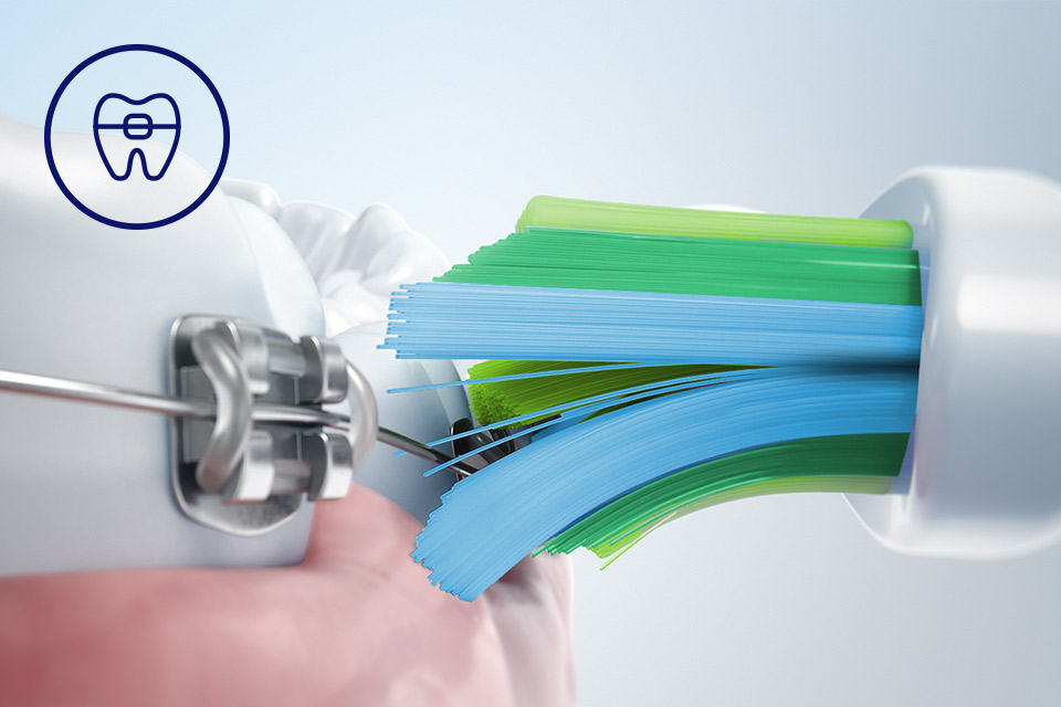 Philips Bezpieczeństwo dla aparat&oacute;w, implant&oacute;w i koron