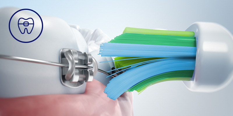 Philips Bezpieczeństwo dla aparat&oacute;w, implant&oacute;w i koron