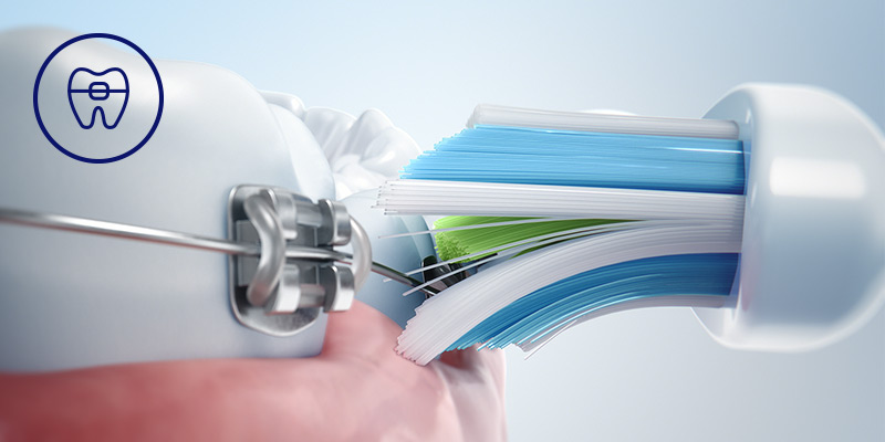 Philips Bezpieczeństwo dla aparatów, implantów i koron