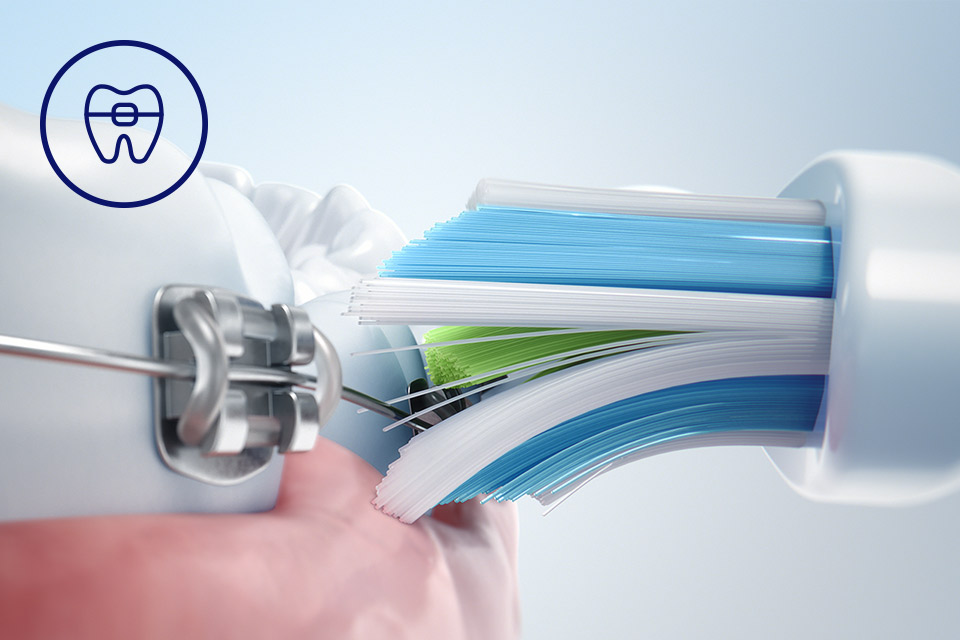 Philips Bezpieczeństwo dla aparatów, implantów i koron