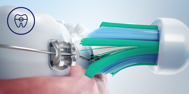 Philips Bezpieczeństwo dla aparat&oacute;w, implant&oacute;w i koron