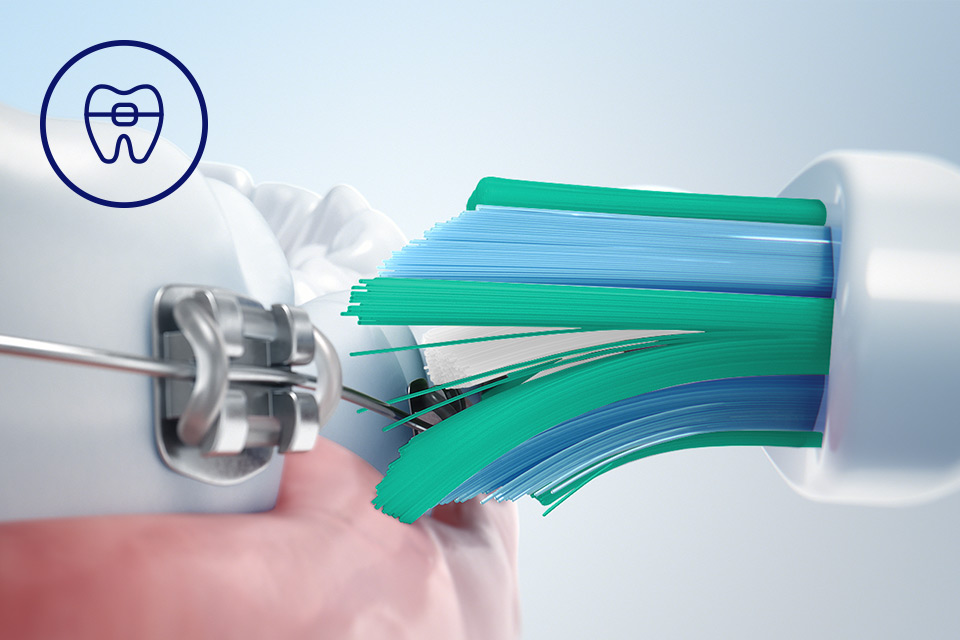 Philips Bezpieczeństwo dla aparat&oacute;w, implant&oacute;w i koron