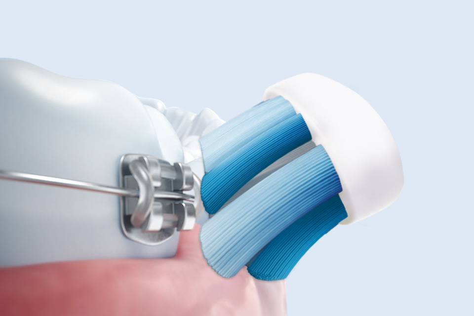 Philips Bezpieczeństwo dla aparat&oacute;w, implant&oacute;w i koron