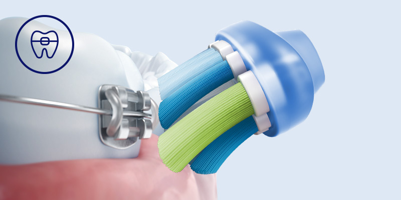 Philips Bezpieczeństwo dla aparatów, implantów i koron