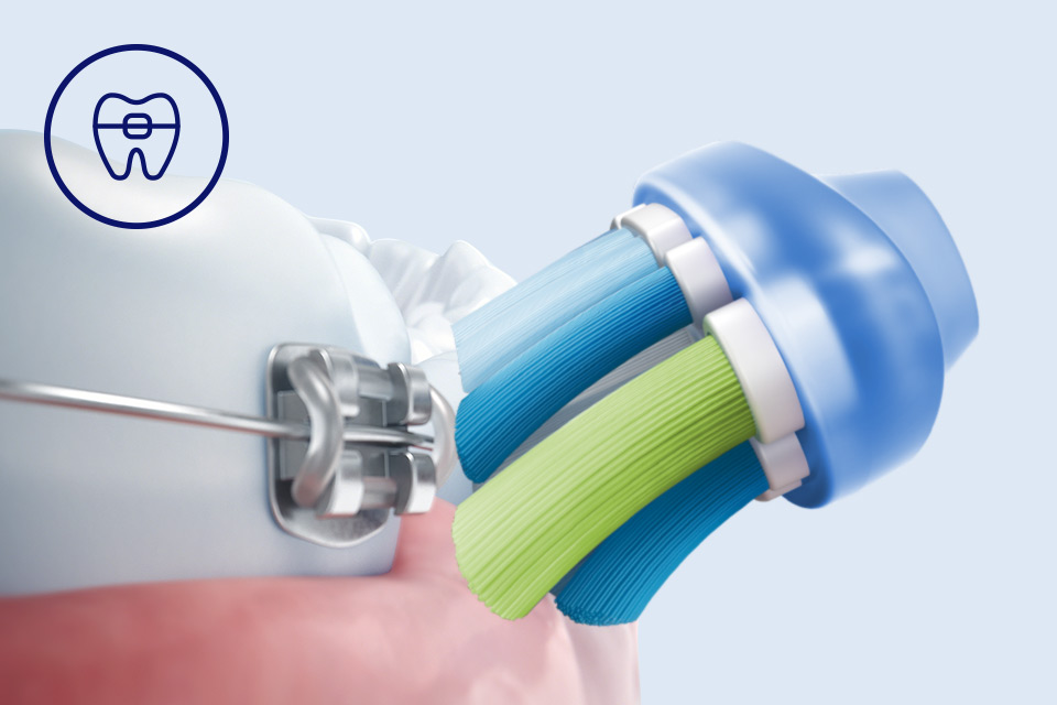 Philips Bezpieczeństwo dla aparatów, implantów i koron