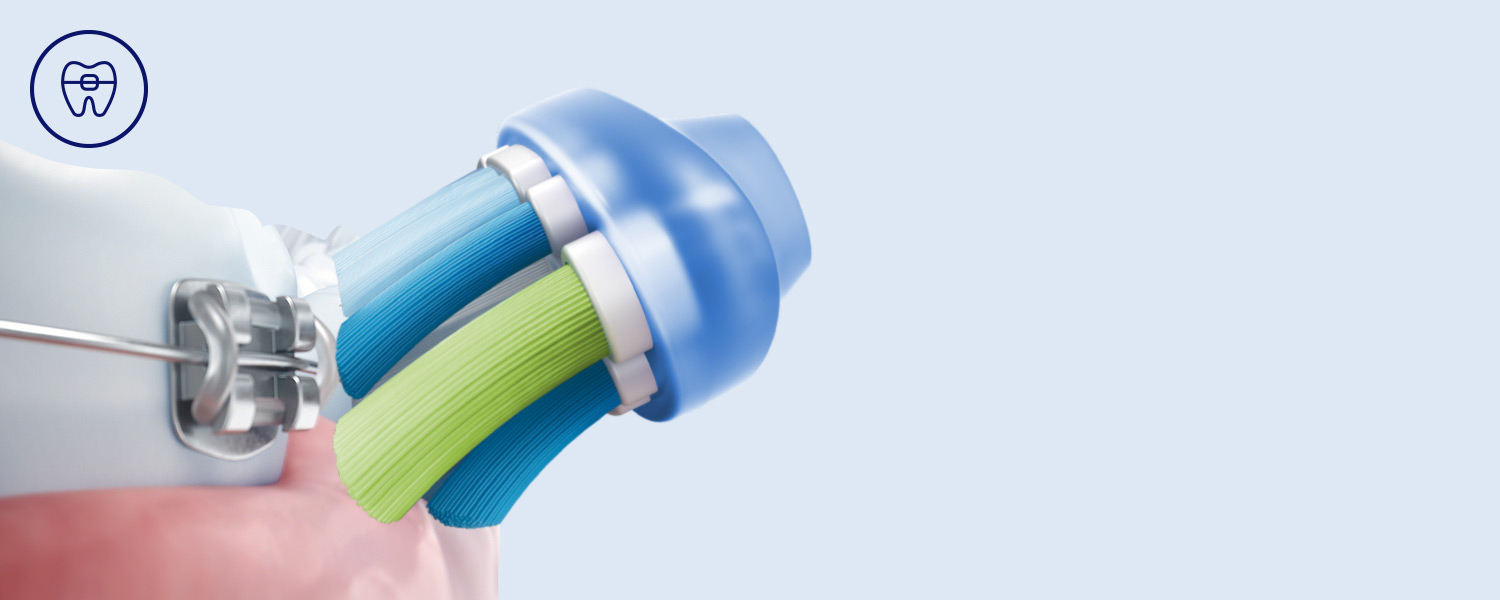 Philips Bezpieczeństwo dla aparatów, implantów i koron