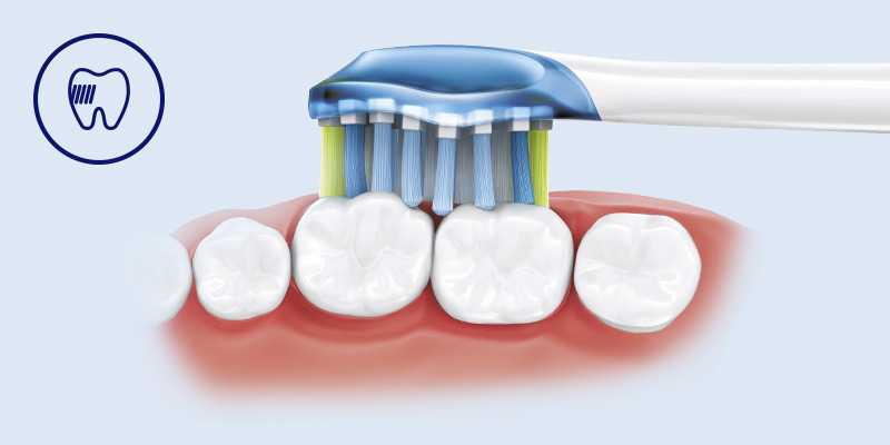 Philips Nasza najgłębiej czyszcząca końcówka Philips Sonicare*