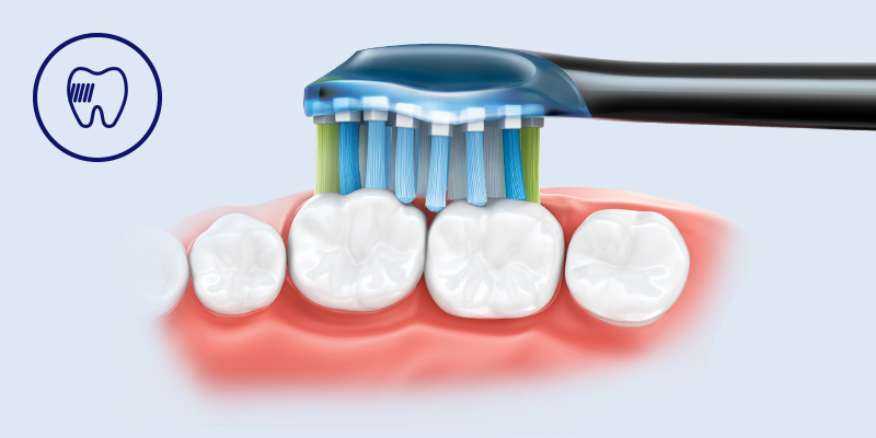 Philips Nasza najgłębiej czyszcząca końc&oacute;wka Philips Sonicare*