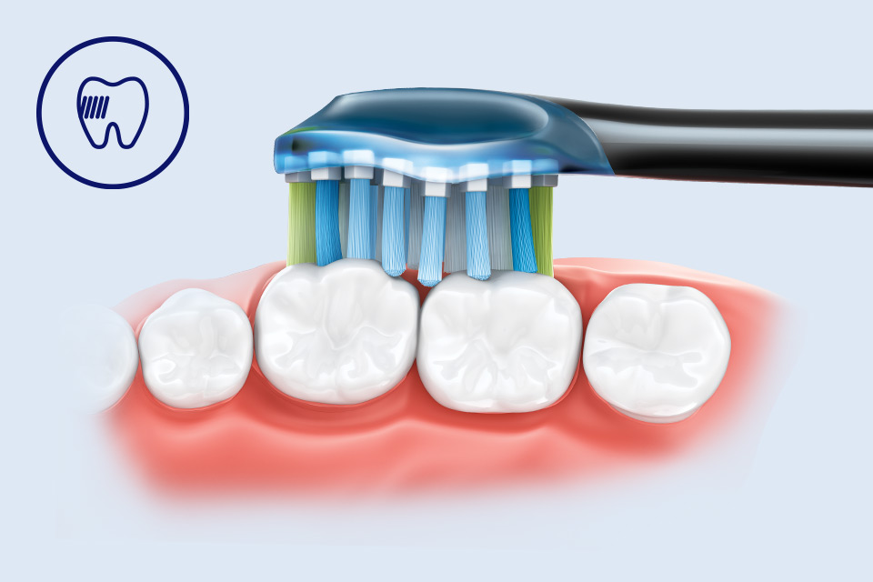 Philips Nasza najgłębiej czyszcząca końc&oacute;wka Philips Sonicare*