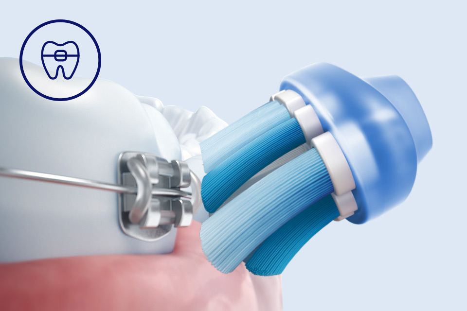 Philips Bezpieczeństwo dla aparat&oacute;w, implant&oacute;w i koron