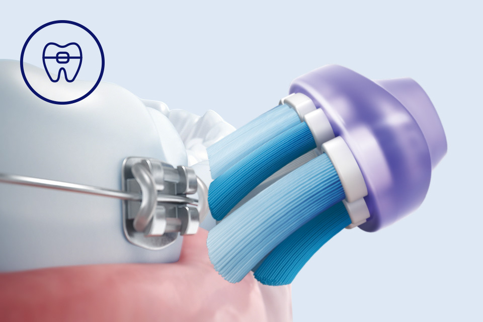Philips Bezpieczeństwo dla aparat&oacute;w, implant&oacute;w i koron