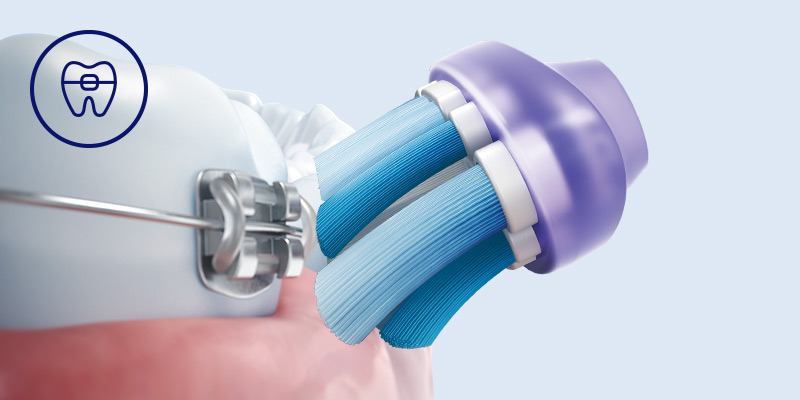 Philips Bezpieczeństwo dla aparat&oacute;w, implant&oacute;w i koron