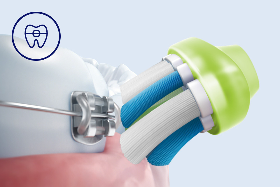 Philips Bezpieczeństwo dla aparat&oacute;w, implant&oacute;w i koron