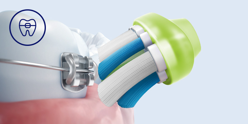 Philips Bezpieczeństwo dla aparat&oacute;w, implant&oacute;w i koron
