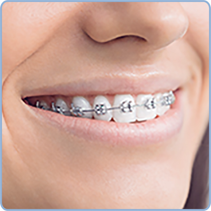 Oral-B