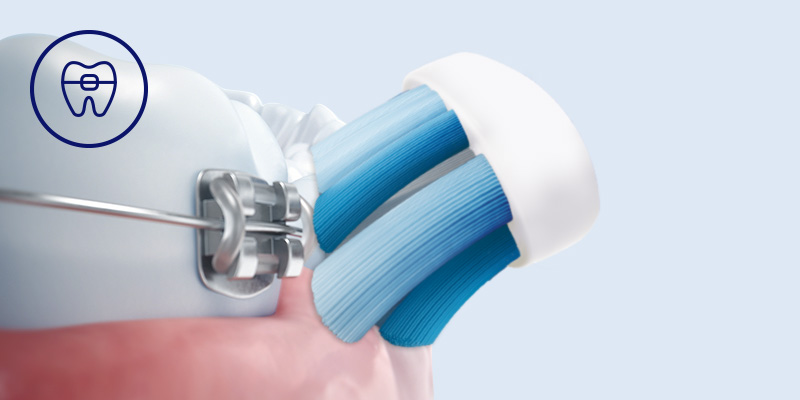 Philips Bezpieczeństwo dla aparat&oacute;w, implant&oacute;w i koron