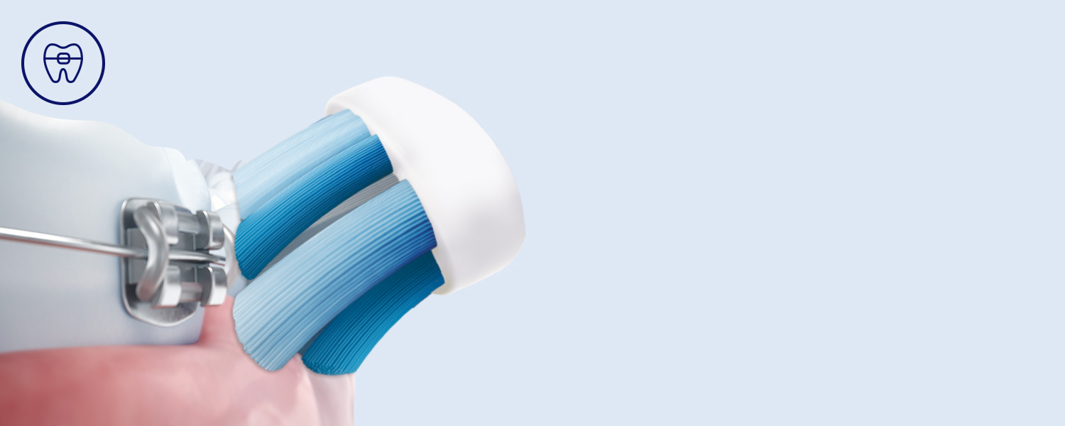 Philips Bezpieczeństwo dla aparat&oacute;w, implant&oacute;w i koron